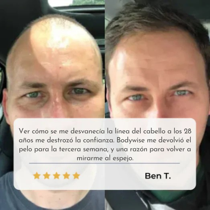 BODYWISE DETIENE Y ACTIVA EL CRECIMIENTO